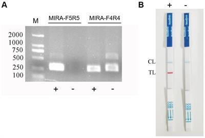 Recombinase polymerase amplification combined with lateral flow biosensor for rapid visual detection of Clostridium perfringens in chicken meat and milk